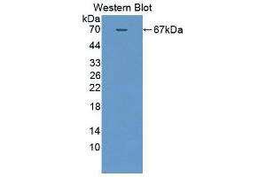 Western blot analysis of the recombinant protein. (SMPD2 抗体  (AA 1-324))