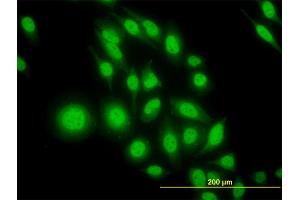 Immunofluorescence of monoclonal antibody to ATF4 on HeLa cell.