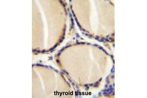 CALCA Antibody (Center) immunohistochemistry analysis in formalin fixed and paraffin embedded human thyroid tissue followed by peroxidase conjugation of the secondary antibody and DAB staining. (CGRP 抗体  (Middle Region))