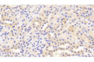 Detection of MMP3 in Mouse Kidney Tissue using Polyclonal Antibody to Matrix Metalloproteinase 3 (MMP3)