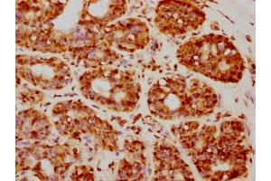 IHC image of nforHU diluted at 1:20 and staining in paraffin-embedded human breast cancer performed on a Leica BondTM system. (Histone H2B 抗体  (AA 2-13))