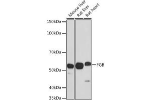 Western blot analysis of extracts of various cell lines, using FGB antibody (ABIN3021949, ABIN3021950, ABIN3021951 and ABIN6218213) at 1:1000 dilution. (Fibrinogen beta Chain 抗体  (AA 202-491))