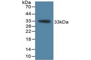 Detection of Recombinant KHDRBS1, Mouse using Polyclonal Antibody to KH Domain Containing, RNA Binding, Signal Transduction Associated Protein 1 (KHDRBS1) (KHDRBS1 抗体  (AA 156-381))