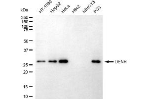 Western blotting analysis using DENR antibody (ABIN7798306). (Density Regulated Protein 抗体)