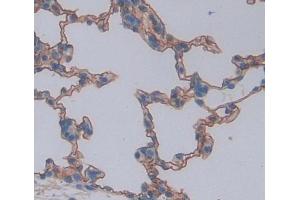 Used in DAB staining on fromalin fixed paraffin- embedded lung tissue (ABCA8 抗体  (AA 1305-1516))