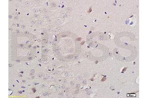 Formalin-fixed and paraffin embedded: rat brain tissue labeled with Anti-iNOS Polyclonal Antibody (ABIN725675) , Unconjugated at 1:200 followed by conjugation to the secondary antibody and DAB staining (NOS2 抗体)