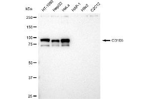 Western blotting analysis using CD105 antibody (ABIN7798440). (Recombinant Endoglin 抗体)