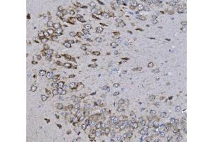 IHC analysis of KCNQ5 using anti-KCNQ5 antibody (ABIN7602178).