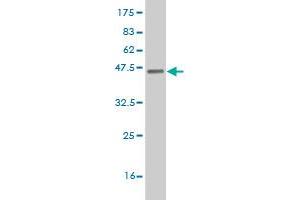 Western Blot detection against Immunogen (37. (ETV5 抗体  (AA 181-290))