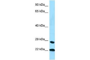 WB Suggested Anti-Ppic Antibody   Titration: 1.