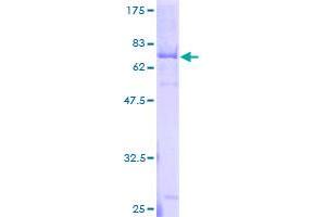 NOTUM Protein (AA 1-430) (GST tag)