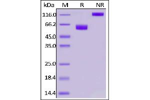 SDS-PAGE (SDS) image for Programmed Cell Death 1 (PDCD1) (AA 25-167) (Active) protein (His tag,Fc Tag,AVI tag,Biotin) (ABIN6973192)