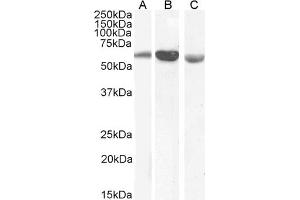 Western Blotting (WB) image for anti-Formiminotransferase Cyclodeaminase (FTCD) (Internal Region) antibody (ABIN185268)