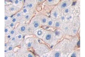 Detection of CD299 in Human Liver Tissue using Polyclonal Antibody to Cluster Of differentiation 299 (CD299)