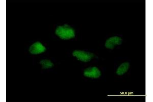 Immunofluorescence of purified MaxPab antibody to PSMB3 on HeLa cell. (PSMB3 抗体  (AA 1-205))