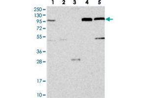 Western blot analysis of Lane 1: RT-4, Lane 2: U-251 MG, Lane 3: Human Plasma, Lane 4: Liver, Lane 5: Tonsil with COPB2 polyclonal antibody . (COPB2 抗体)