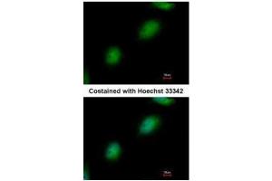 ICC/IF Image Immunofluorescence analysis of paraformaldehyde-fixed HeLa, using TPRKB, antibody at 1:500 dilution. (TPRKB 抗体)