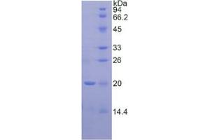 SDS-PAGE analysis of Human Corticosteroid Binding Globulin (CBG) Protein. (SERPINA6 蛋白)