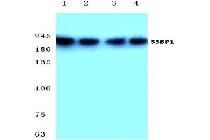 Western blot analysis of 53BP1 antibody at 1/500 dilution: Lane 1: Hela cell lysate. (TP53BP1 抗体)