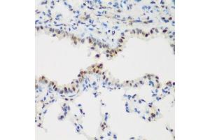 Immunohistochemistry (Paraffin-embedded Sections) (IHC (p)) image for anti-Proliferating Cell Nuclear Antigen (PCNA) (AA 1-261) antibody (ABIN3020826)