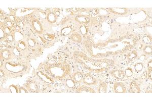Detection of IGSF1 in Human Kidney Tissue using Polyclonal Antibody to Immunoglobulin superfamily, member 1 (IGSF1) (IGSF1 抗体  (AA 1008-1227))