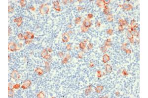 Immunohistochemistry (IHC) image for anti-Tumor Necrosis Factor Receptor Superfamily, Member 8 (TNFRSF8) antibody (ABIN6941150)