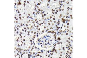 Immunohistochemistry of paraffin-embedded mouse kidney using Phospho-STA-Y694 antibody (ABIN6135328, ABIN6136272, ABIN6136273 and ABIN7101887) at dilution of 1:100 (40x lens). (STAT5A 抗体  (pTyr694))