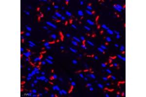 Immunofluorescence of paraffin embedded mouse heart using THNSL2 (ABIN7075893) at dilution of 1: 400 (400x lens) (THNSL2 抗体)