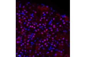 Immunofluorescence of paraffin embedded rat kidney using ZHX3 (ABIN7076287) at dilution of 1:650 (400x lens) (ZHX3 抗体)