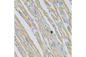 Immunohistochemistry of paraffin-embedded rat heart using PRNP Antibody (ABIN5971407) at dilution of 1/100 (40x lens). (PRNP 抗体)