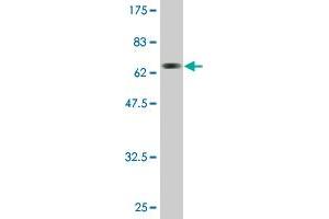 Western Blot detection against Immunogen (69. (ACAT2 抗体  (AA 1-397))