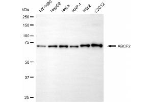 Western blotting analysis using ABCF2 antibody (ABIN7797690). (ABCF2 抗体)