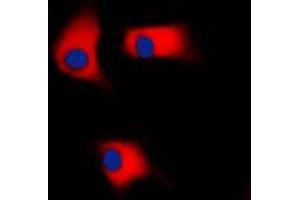 Immunofluorescent analysis of CK1 gamma 2 staining in Raw264. (Casein Kinase 1 gamma 2 抗体  (N-Term))