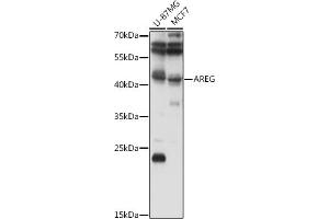 Western blot analysis of extracts of various cell lines, using AREG antibody (ABIN6127431, ABIN6137065, ABIN6137066 and ABIN6216408) at 1:1000 dilution. (Amphiregulin 抗体  (AA 20-252))