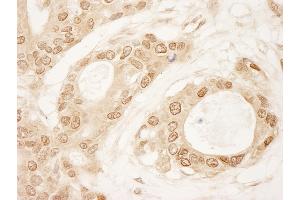 Immunohistochemistry (IHC) image for anti-Chromosome 1 Open Reading Frame 55 (C1orf55) (AA 350-400) antibody (ABIN7448452) (C1orf55 抗体  (AA 350-400))