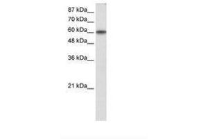 Image no. 1 for anti-Kruppel-Like Factor 11 (KLF11) (AA 61-110) antibody (ABIN203187) (KLF11 抗体  (AA 61-110))