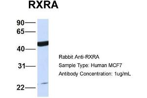 Host:  Rabbit  Target Name:  RXRA  Sample Type:  Human MCF7  Antibody Dilution:  1. (Retinoid X Receptor alpha 抗体  (N-Term))