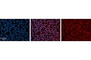 NR2F6 antibody - N-terminal region          Formalin Fixed Paraffin Embedded Tissue:  Human Liver Tissue    Observed Staining:  Nucleus in hepatocytes   Primary Antibody Concentration:  1:100    Other Working Concentrations:  1/600    Secondary Antibody:  Donkey anti-Rabbit-Cy3    Secondary Antibody Concentration:  1:200    Magnification:  20X    Exposure Time:  0.