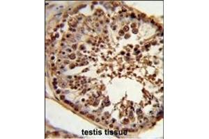 Immunohistochemistry (Paraffin-embedded Sections) (IHC (p)) image for anti-Centrosome and Spindle Pole Associated Protein 1 (Cspp1) (AA 304-333), (N-Term) antibody (ABIN653334)