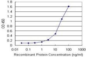 Detection limit for recombinant GST tagged FTL is 1 ng/ml as a capture antibody. (FTL 抗体)