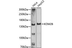Western blot analysis of extracts of various cell lines, using KDM2B antibody (ABIN7268327) at 1:1000 dilution. (KDM2B 抗体  (AA 600-700))