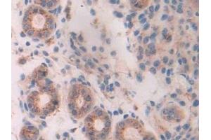 Immunohistochemistry (IHC) image for anti-Tripeptidyl Peptidase I (TPP1) (AA 198-562) antibody (ABIN7440935)