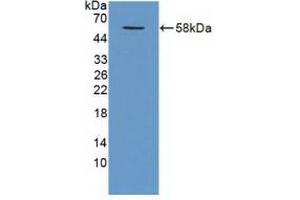 Detection of Recombinant TRAF1, Human using Polyclonal Antibody to TNF Receptor Associated Factor 1 (TRAF1) (TRAF1 抗体  (AA 131-381))