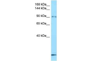 WB Suggested Anti-Fbxo11 Antibody   Titration: 1. (FBXO11 抗体  (C-Term))