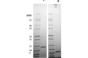 SDS-PAGE of Human Resistin Dimer Recombinant Protein SDS-PAGE of Human Resistin Dimer Recombinant Protein. (Resistin Dimer 蛋白)