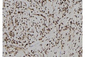 ABIN6273180 at 1/100 staining Human gastric tissue by IHC-P. (TARBP2 抗体  (Internal Region))