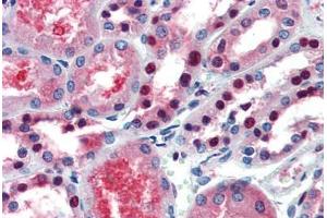 Human Kidney (formalin-fixed, paraffin-embedded) stained with PAX7 antibody ABIN462176 followed by biotinylated goat anti-rabbit IgG secondary antibody ABIN481713, alkaline phosphatase-streptavidin and chromogen. (PAX7 抗体  (AA 167-216))