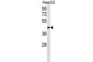 Western Blotting (WB) image for anti-RCSD Domain Containing 1 (RCSD1) antibody (ABIN2999986)