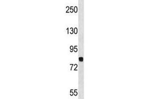 Dyrk1a antibody western blot analysis in NCI-H460 lysate. (DYRK1A 抗体  (AA 718-745))