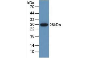 Detection of Recombinant MUSK, Mouse using Polyclonal Antibody to Muscle, Skeletal, Receptor Tyrosine Kinase (MUSK) (MUSK 抗体  (AA 517-777))